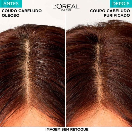 Elseve Pure Hialurônico Shampoo 400ml