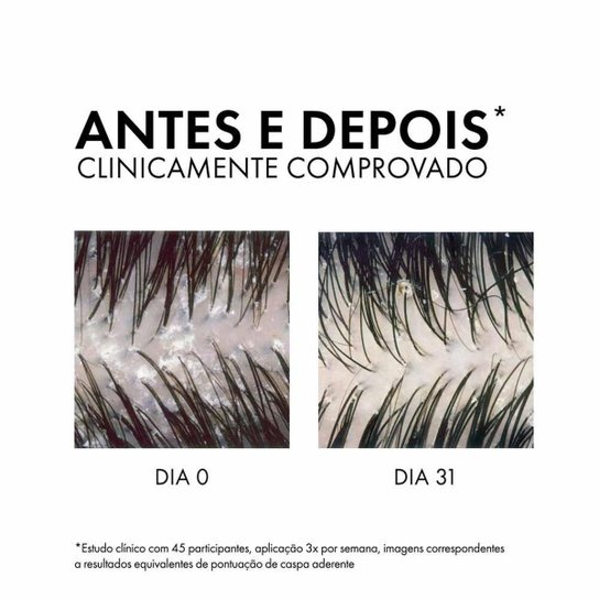 Vichy Dercos Shampoo Anticaspa DS - Cabelos Normais a Oleosos Refil 200g